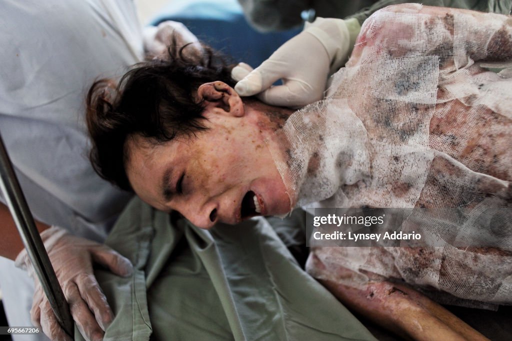 Self-Immolation in Afghanistan