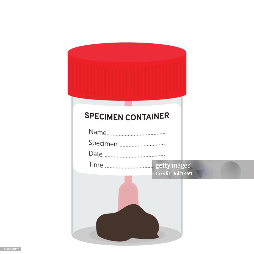 The stool sample in the jar