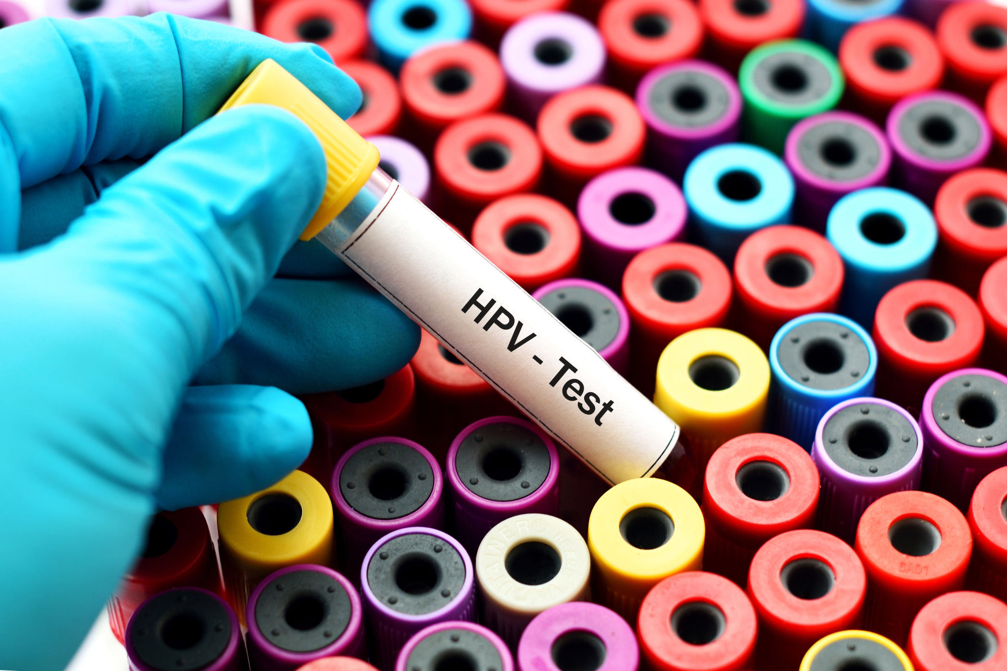 HPV test HPV test