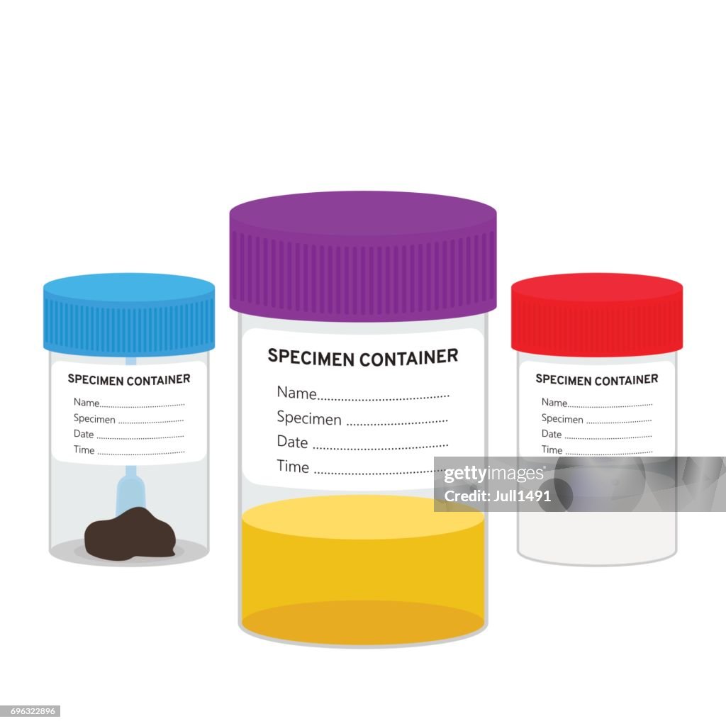 Semen samples, stool and urine sample in the plastic jars