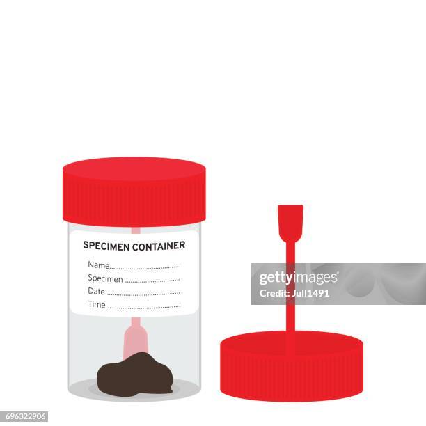 the stool sample - stool stock illustrations