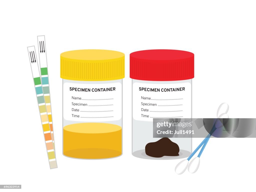 Laboratory tests. Two jars with samples of urine and stools.