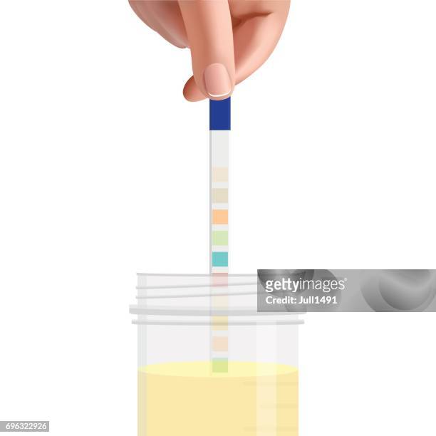 der mann senkt seine urin-teststreifen in ein glas mit urin. - urine sample stock-grafiken, -clipart, -cartoons und -symbole