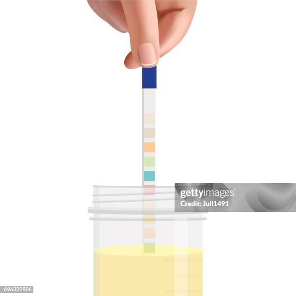 the man lowers his urine test strip in a jar of urine. - urine sample stock illustrations