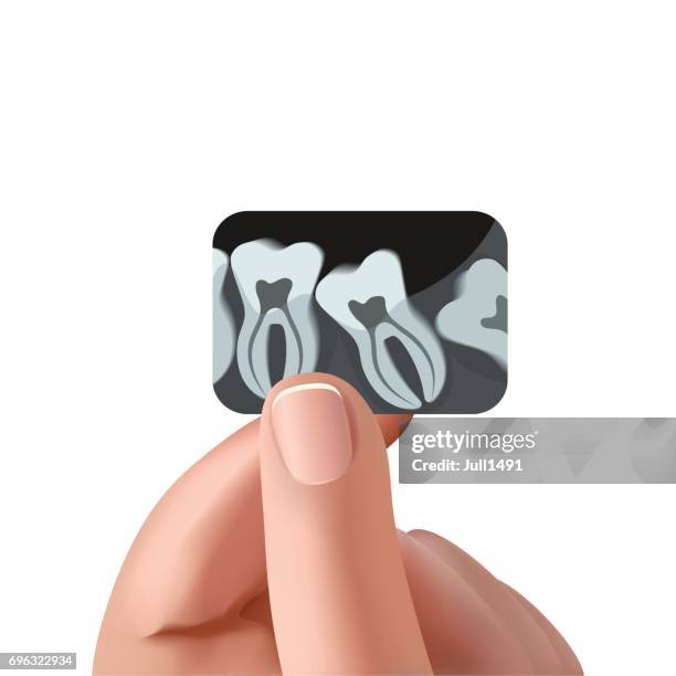 ilustraciones, imágenes clip art, dibujos animados e iconos de stock de hombre tiene un negro radiografías de los dientes - radiologia dental