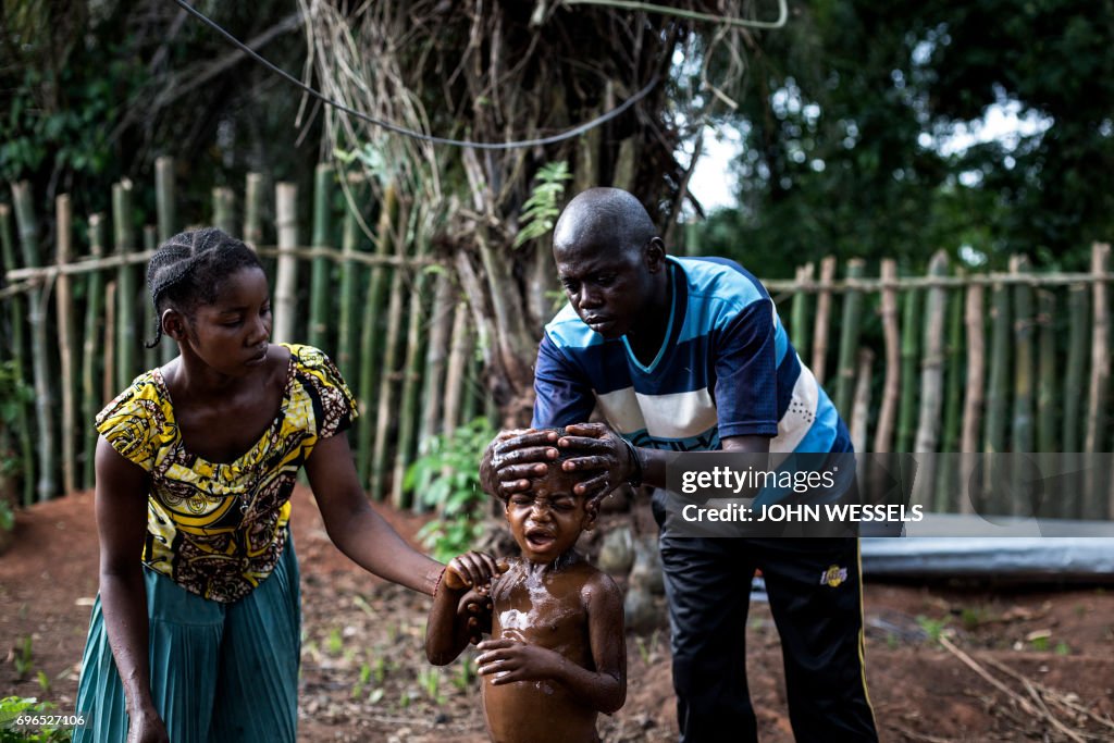 TOPSHOT-DRCONGO-HEALTH-MALARIA