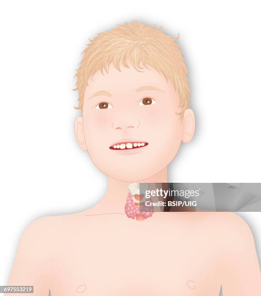 thyroid, illustration - thyroid cartilage stock illustrations