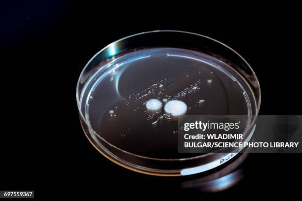 petri dish with fungi - boîte de pétri photos et images de collection