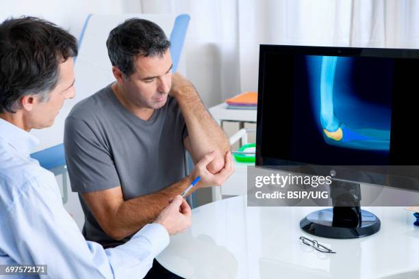 rheumatology consultation man - rheumatology stock pictures, royalty-free photos & images