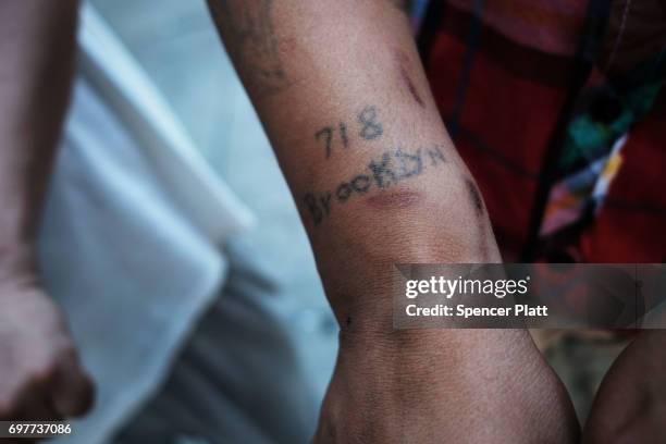 Superman," a patient at a Brooklyn methadone clinic for those addicted to heroin, displays a tattoo with track marks on his arm as he continues to...