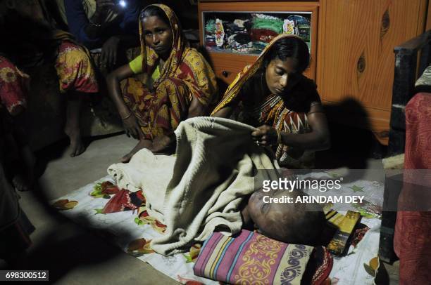 In this photograph taken June 19, 2017 Fatema Begum covers the body of her daughter Roona, who was suffering from hydrocephalus, at their hut in...