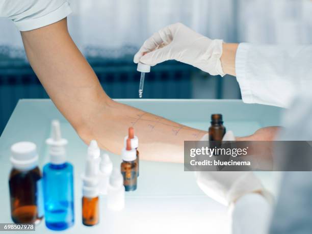 peau prick test allergologique - allergie photos et images de collection