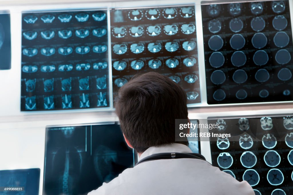 Hispanic doctor examining x-rays
