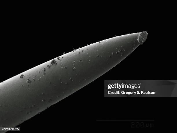 acupuncture needle - acupuncture needle stock pictures, royalty-free photos & images