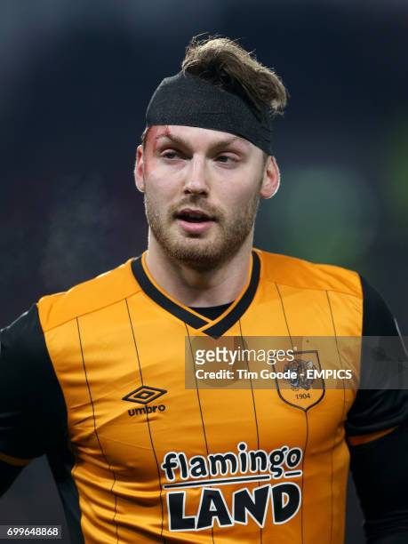 Hull City's Nick Powell wears a bandage after a collision with Arsenal's Per Mertesacker