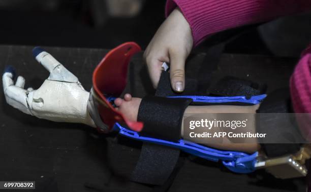 Colombian Shaio Valeria Novas tries her 3D printed prosthesis with a superhero "Wonder Woman" design, in Bogota, Colombia on June 12, 2017. Fabrilab...