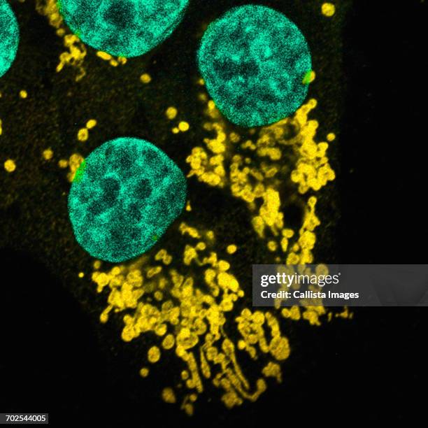 microscopic image of mutated human epithelial cells - oncogene stock pictures, royalty-free photos & images