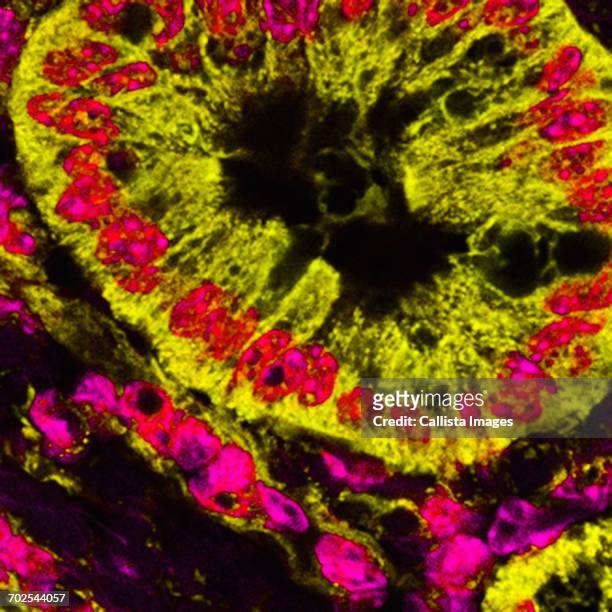 microscopic image of mitochondrial stained pancreatic cancer cells - pancreatic cancer stockfoto's en -beelden