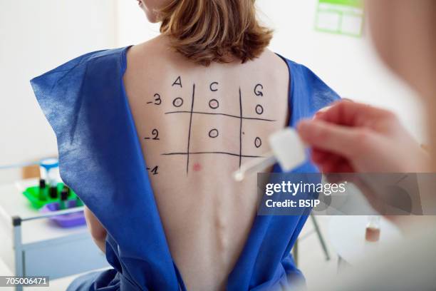 allergy test, woman - allergy test stock pictures, royalty-free photos & images