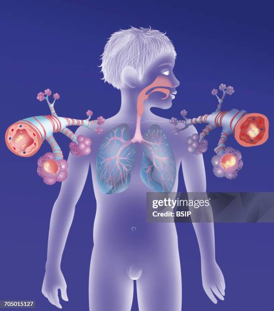 asthma, drawing - copd stock illustrations