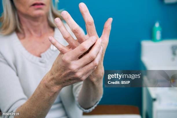 rheumatology, eldery person - rheumatology stock pictures, royalty-free photos & images