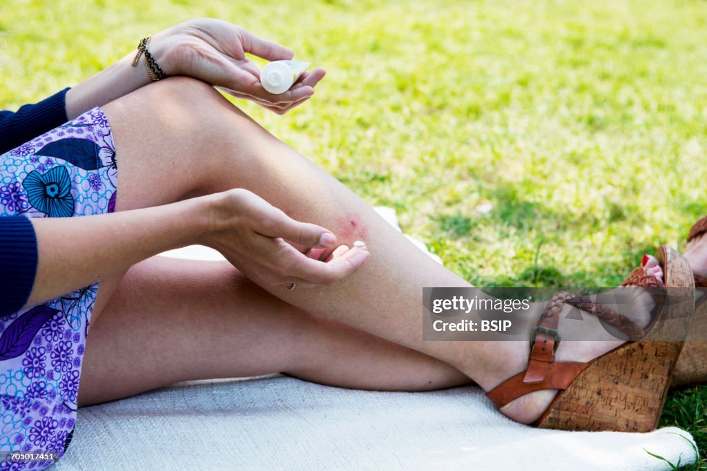 Insect bite