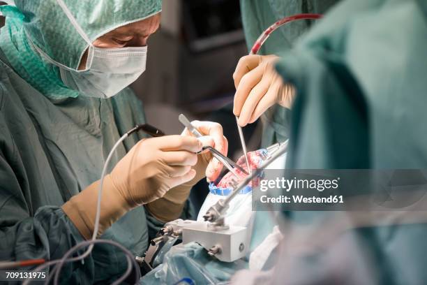 neurosurgeons opening the cranium during an operation - neurocirugia fotografías e imágenes de stock