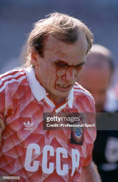 Russian footballer Vagiz Khidiyatullin pictured with blood running down his face from a cut above his eye during play for the Soviet Union team in...