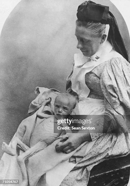 Workhouse nurse holds a malnourished and emaciated baby, circa 1880.