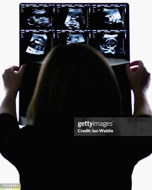 Pregnant woman examines her 18-week ultrasound scan pictures June 7, 2006 in Sydney, Australia. Australia is currently enjoying a baby boom, with the...
