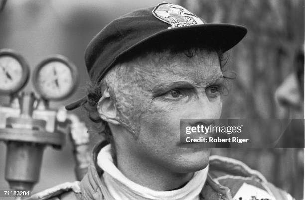 Austrian Grand Prix racing car driver Niki Lauda watches, late 1970s. Lauda was badly burned in a crash during the 1976 season but returned to race...