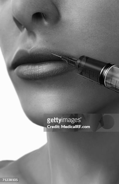 stockillustraties, clipart, cartoons en iconen met close up of a woman's face as she receives botox treatment to her lips - studio shot