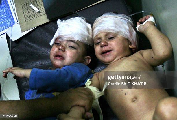 Two Palestinian toddlers with their heads bandaged lie on a trolley at the Naser hospital in the southern Gaza Strip town of Khan Yunis 21 June 2006,...