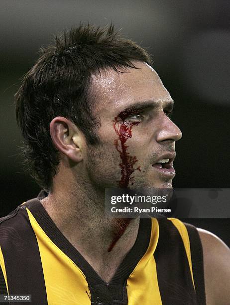 Brent Guerra of the Hawks leaves the field under the blood rule during the round 13 AFL match between the St Kilda Saints and the Hawthorn Hawks at...