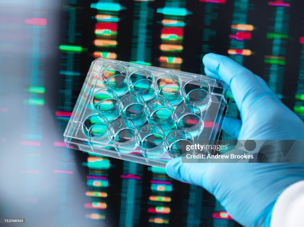 DNA Research, Scientist holding up a multi well plate containing DNA samples with results on the computer screen