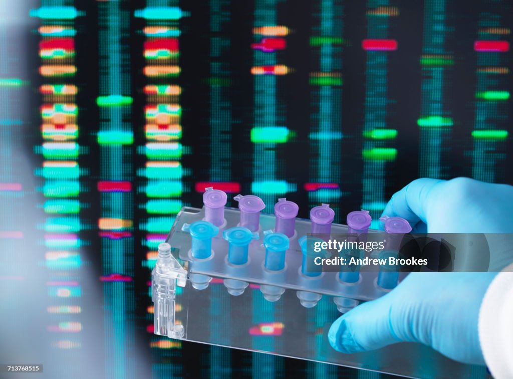Dna Samples Computer Dna Research Scientist Holding Up A Tray Of Dna Samples With Results On ...