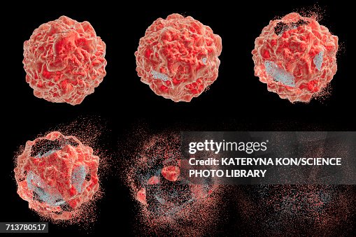 Destruction Of A Cancer Cell Illustration High-Res Vector Graphic ...