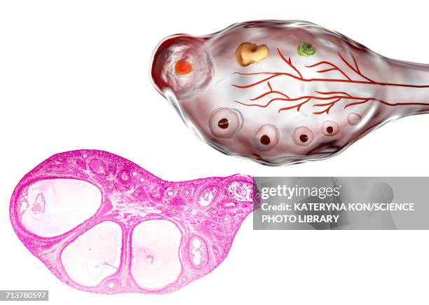 ovarian follicles, micrograph and illustration - 光学顕微鏡図点のイラスト素材／クリップアート素材／マンガ素材／アイコン素材