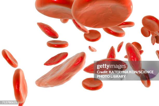 sickle cell red blood cells, illustration - sickle cell stock illustrations