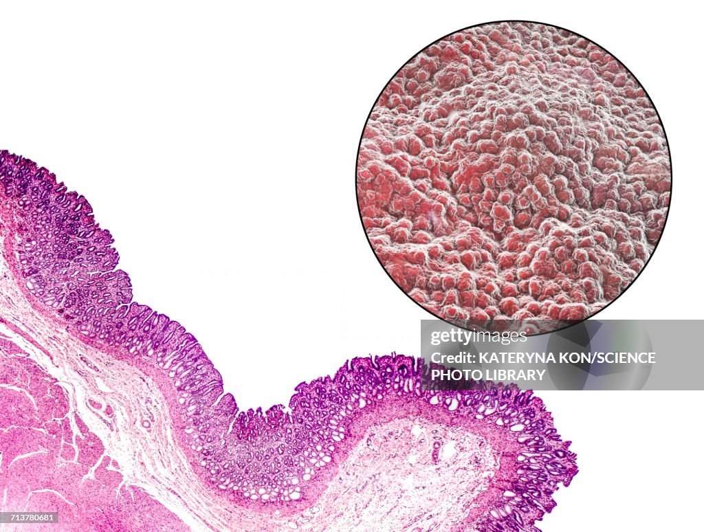 Stomach mucosa, light micrograph and illustration