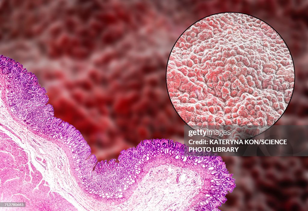 Stomach mucosa, light micrograph and illustration