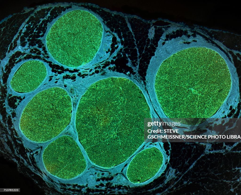 Nerve fibres, LM