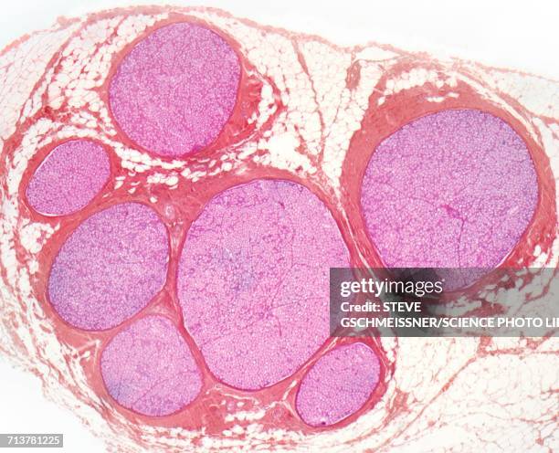 nerve fibres, lm - histology stock illustrations