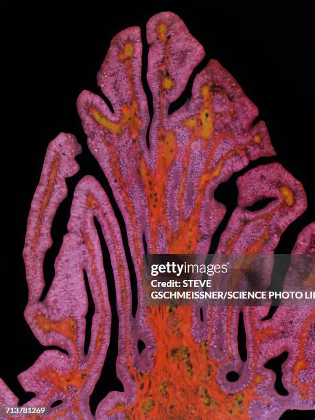 fallopian tube, lm - capillary body part stock illustrations