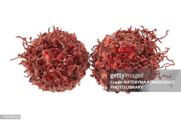 prostate cancer cells, illustration - metastatic tumour stock illustrations