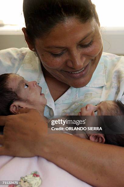 Guatemala City, GUATEMALA: An auxiliary nurse holds the one-month-old cojoined twins Angela Corina and Angela Leticia in her arms at the Roosevelt...
