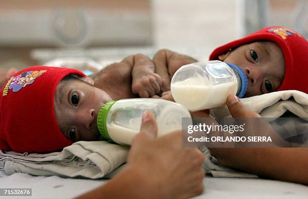 Guatemala City, GUATEMALA: One-month-old cojoined twins Angela Corina and Angela Leticia are bottlefed at the Roosevelt Hospital in Guatemala City,...