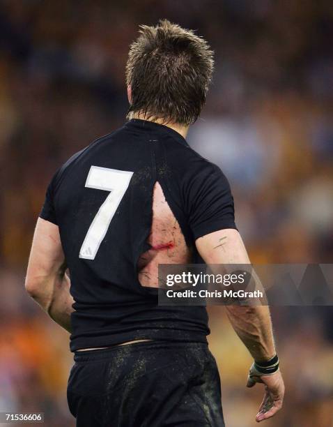 The back of Richie McCaw of the All Blacks shows a large cut during the Tri Nations series Bledisloe Cup match between the Australian Wallabies and...