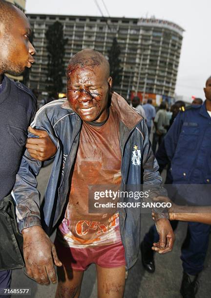 Kinshasa, Democratic Republic of the Congo: A man wounded is led away by policemen during fighting between members of the presidential guard of...