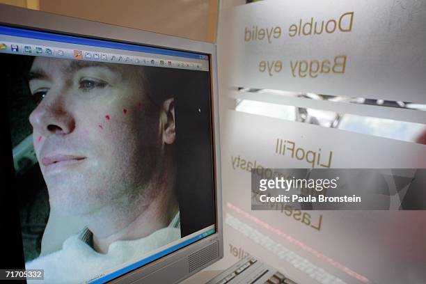 Suspect in the JonBenet Ramsey murder case John Mark Karr is displayed on a computer screen at the Siam Swan Cosmetic Clinic, from when he was a...